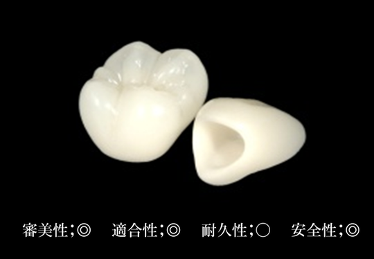 自費の被せ物 - オリーブ歯科（安城市）